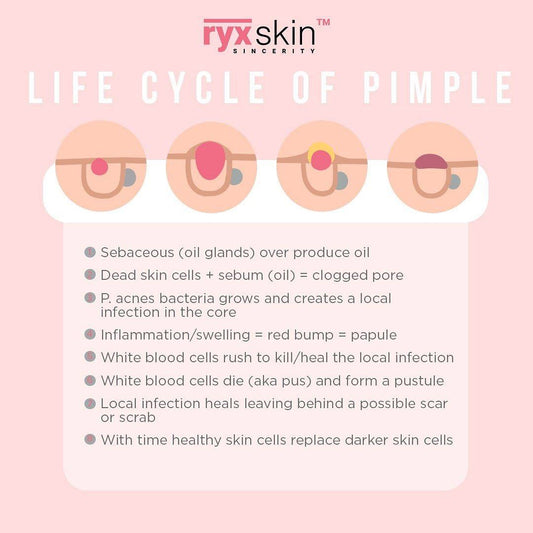 Life Cycle of A Pimple